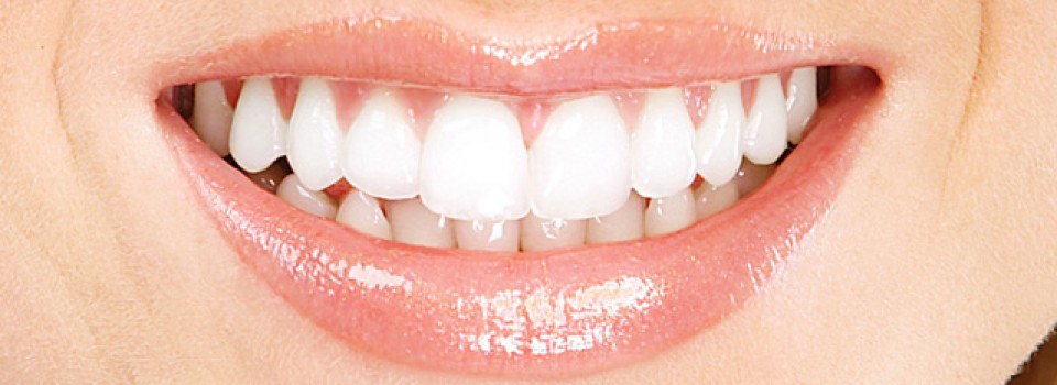 banner-equipe