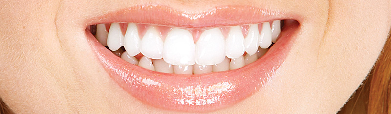 banner-equipe